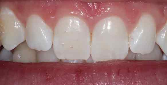 case16b