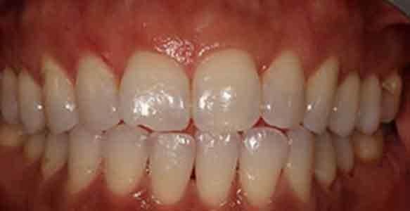 case5b
