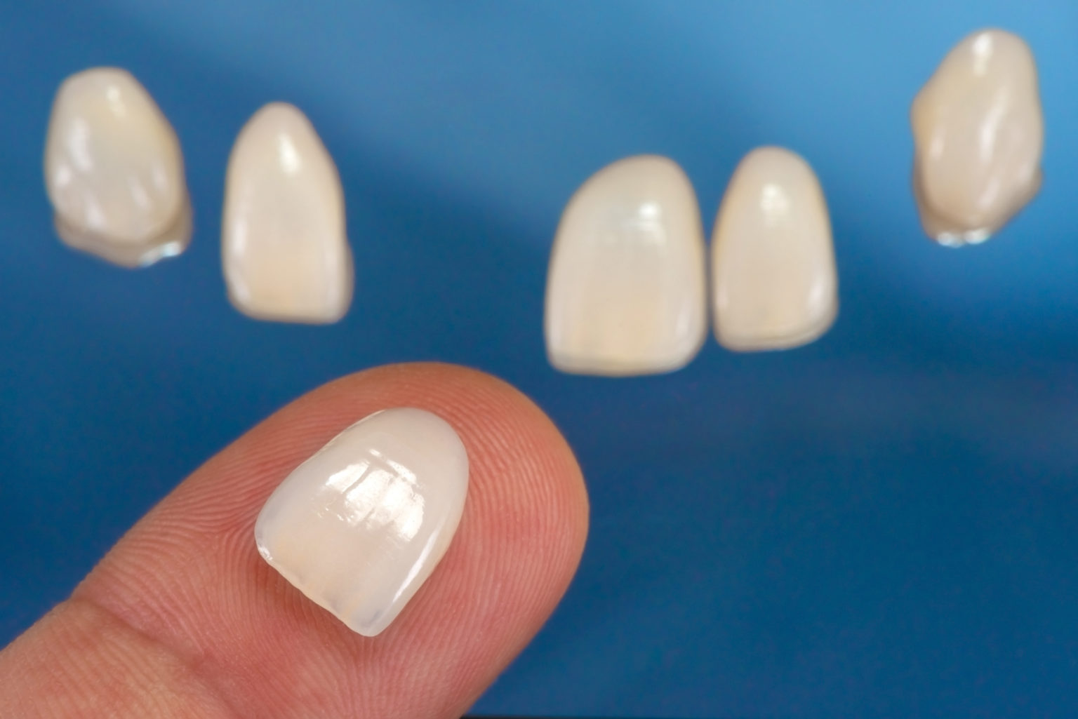 Composite Bonding vs Composite Veneers Which is Right for Me? NYCCD