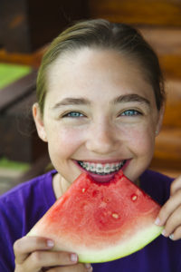  eating the right foods with braces