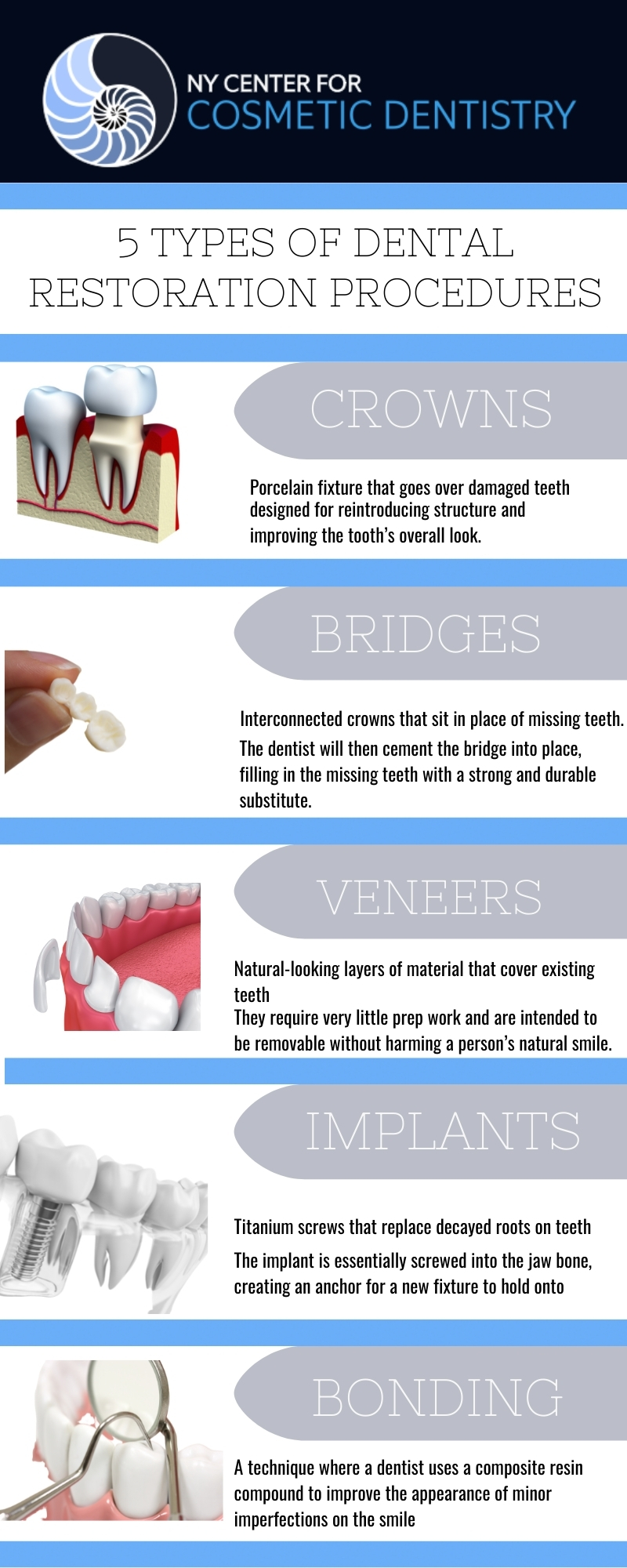 dental restoration infographic