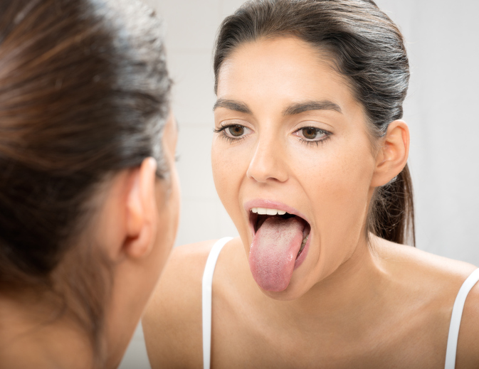 Can a dentist help with a white tongue ?