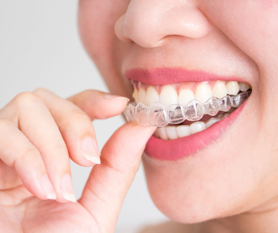 Invisalign New York